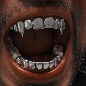 Eight Tooth Tip Tiger Tooth Braces